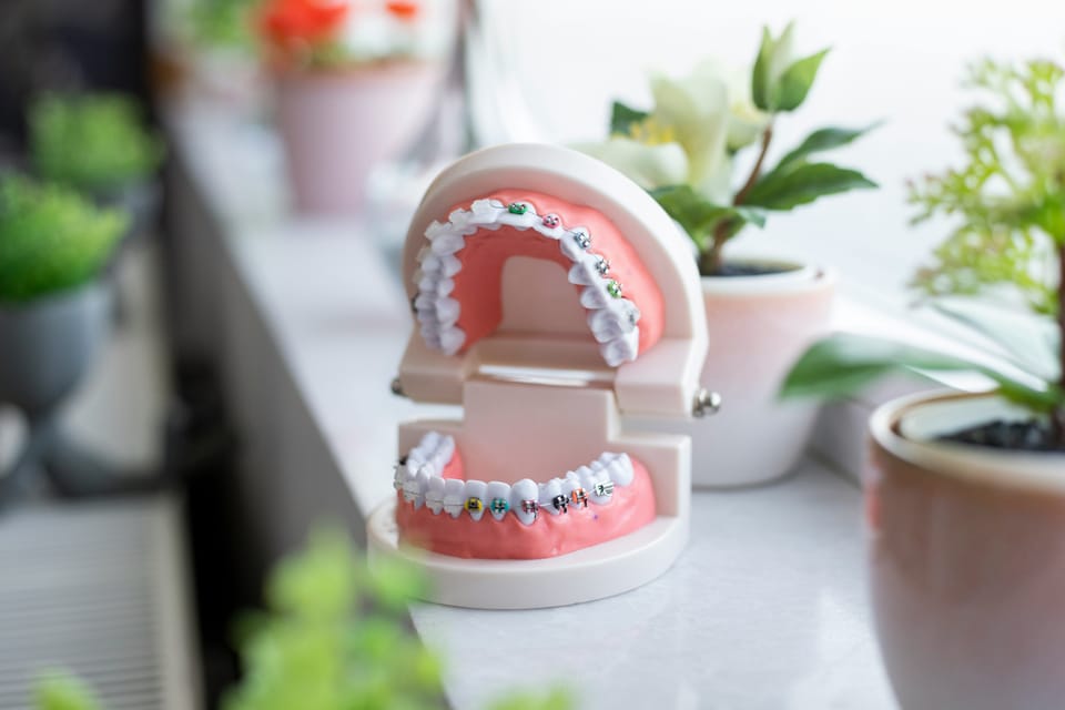 A model of teeth with braces on a windowsill beside potted plants.